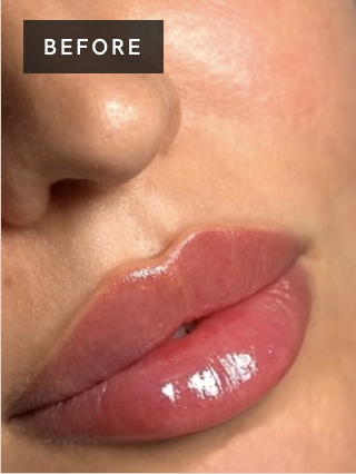 Treatment result before image