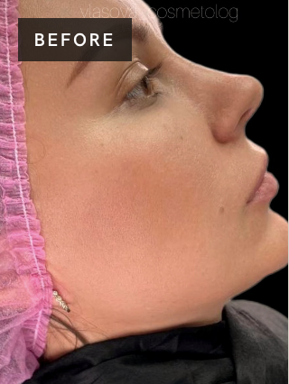 Treatment result before image