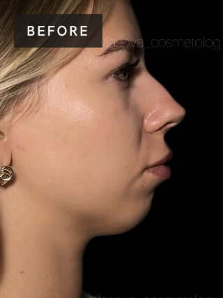 Treatment result before image